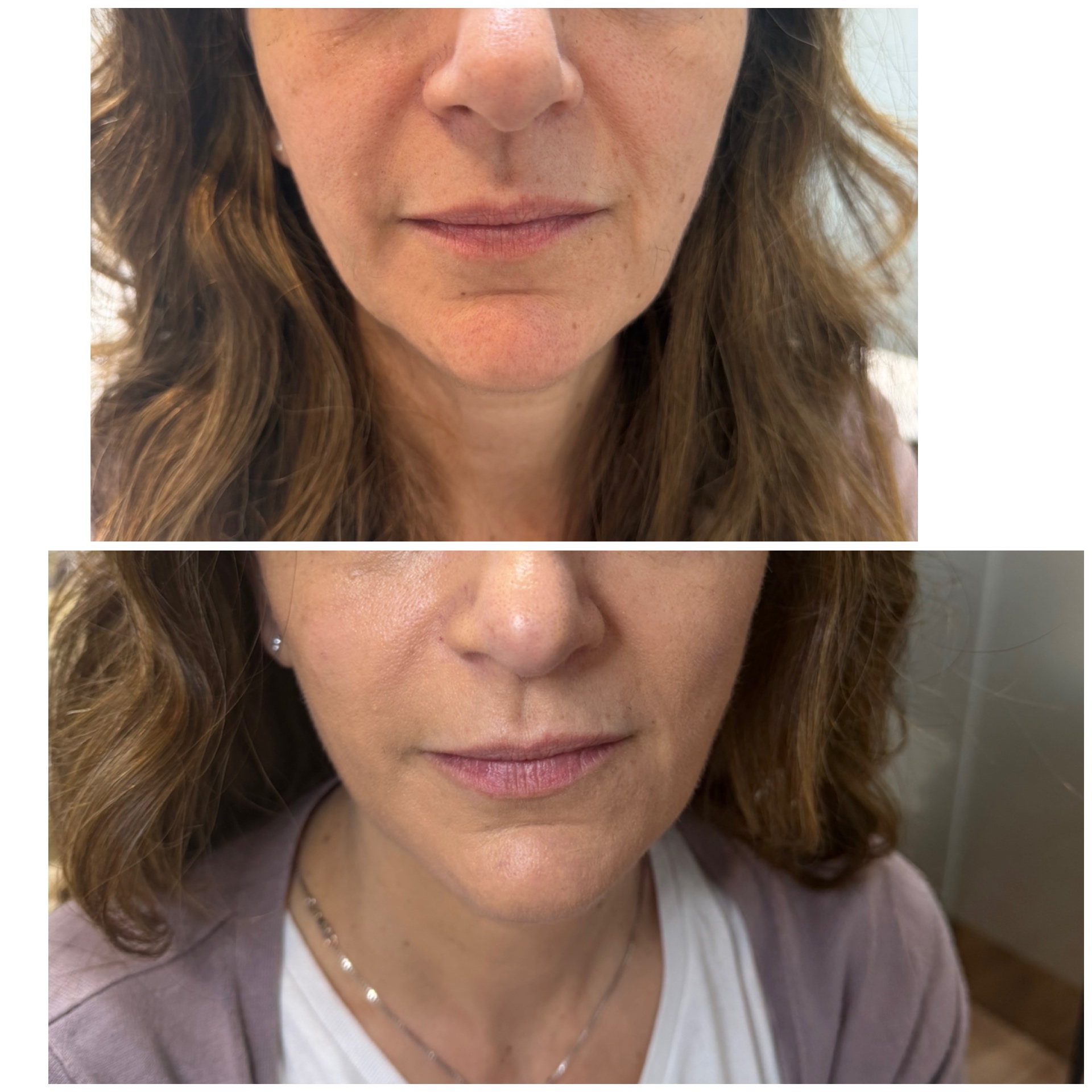 BEAUTY MED SKIN – Ιατρείο Αισθητικής Δερματολογίας - Image 10