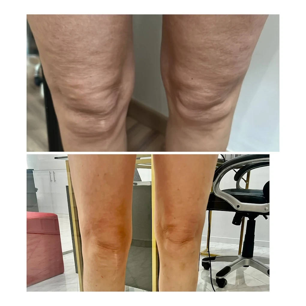 BEAUTY MED SKIN – Ιατρείο Αισθητικής Δερματολογίας - Image 3