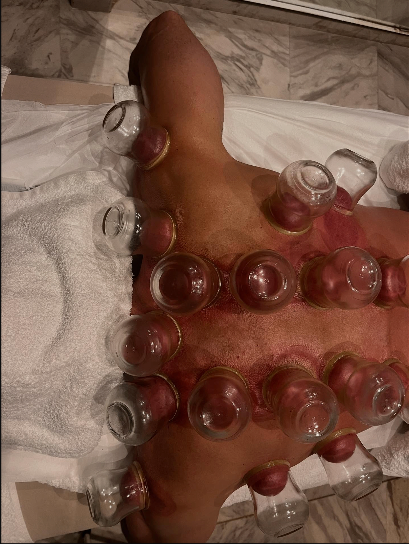Fuzz Massage - Image 18