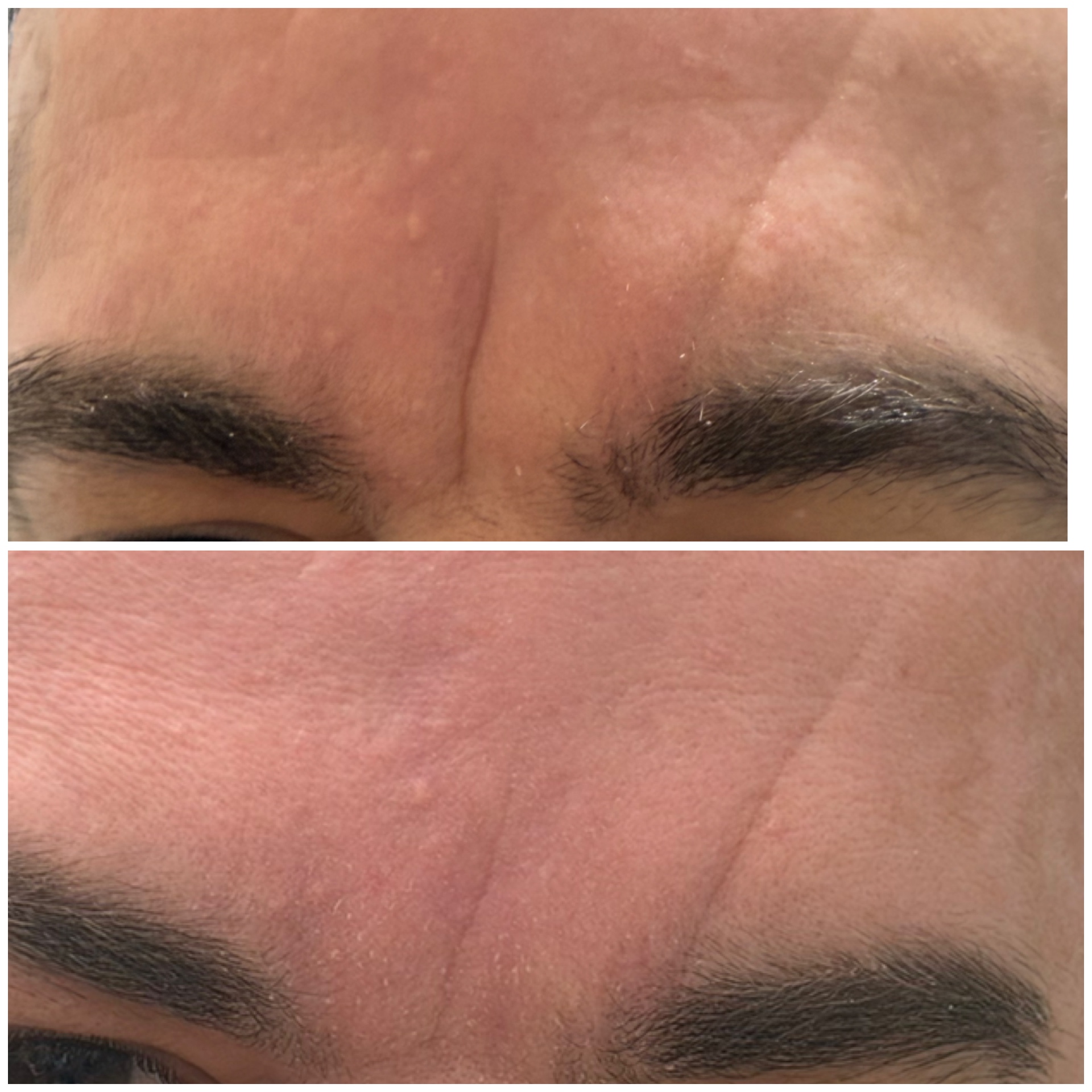 BEAUTY MED SKIN – Ιατρείο Αισθητικής Δερματολογίας - Image 11
