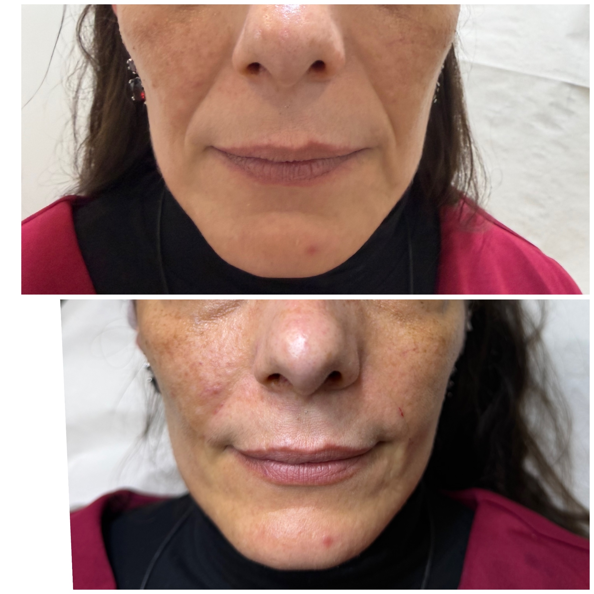 BEAUTY MED SKIN – Ιατρείο Αισθητικής Δερματολογίας - Image 9