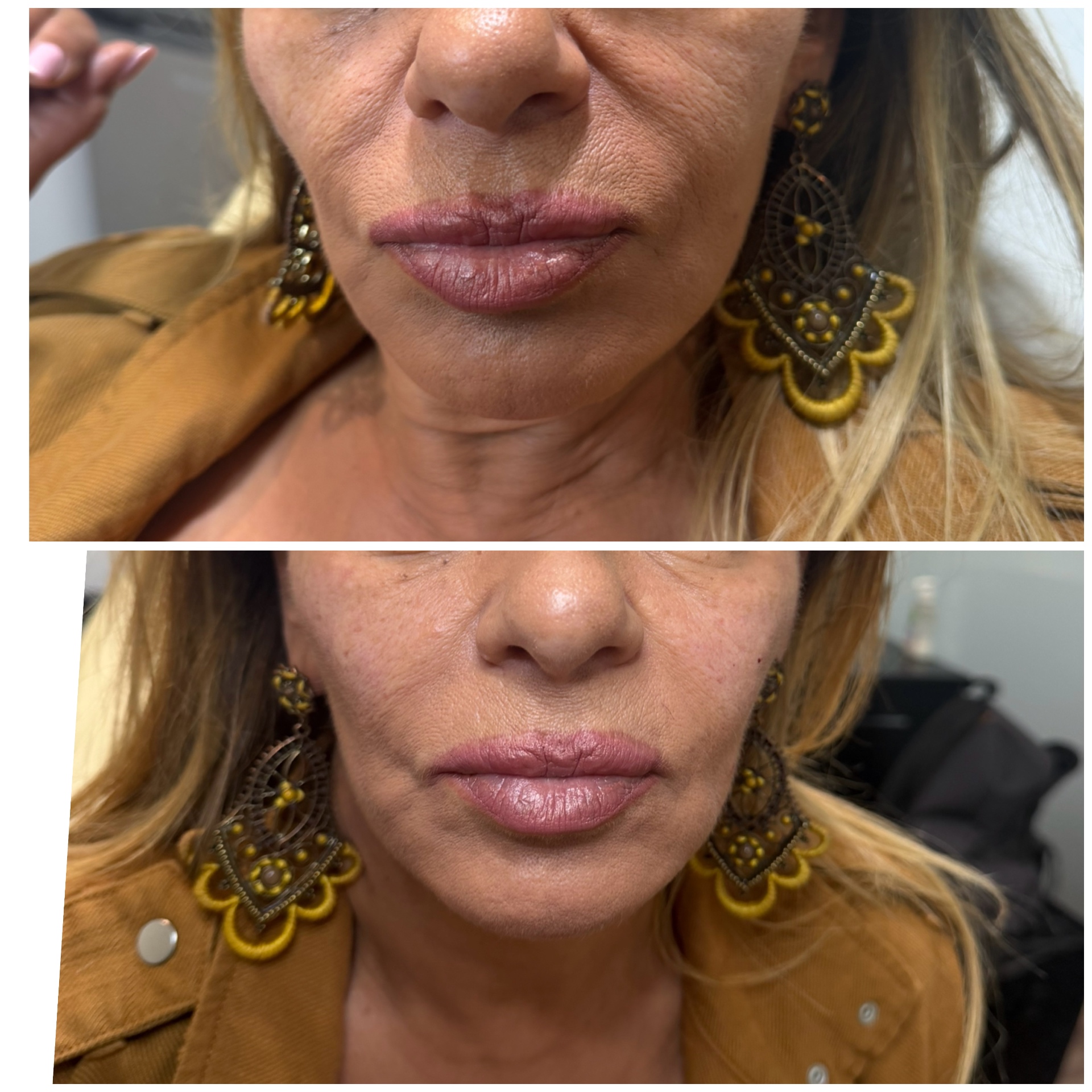 BEAUTY MED SKIN – Ιατρείο Αισθητικής Δερματολογίας - Image 8