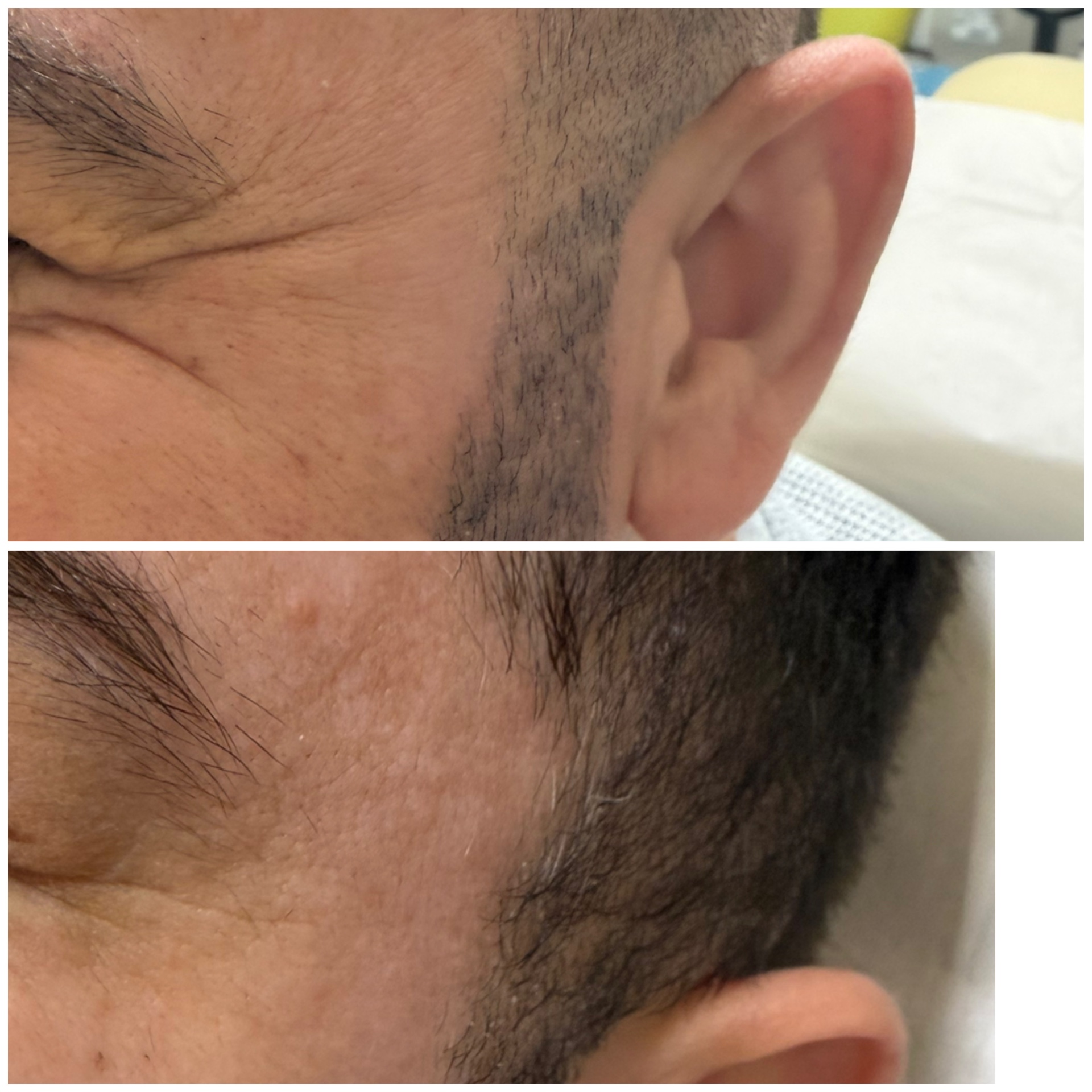 BEAUTY MED SKIN – Ιατρείο Αισθητικής Δερματολογίας - Image 12