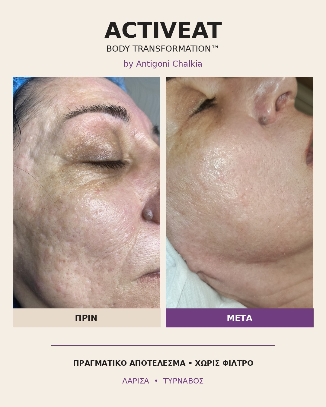 Activeat ProjectB Λάρισα - Image 5