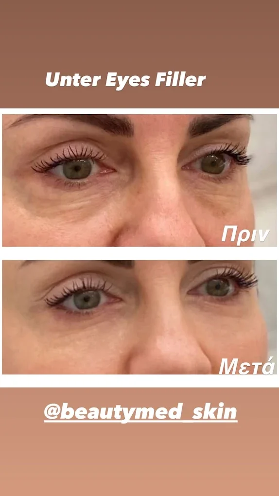 BEAUTY MED SKIN – Ιατρείο Αισθητικής Δερματολογίας - Image 1